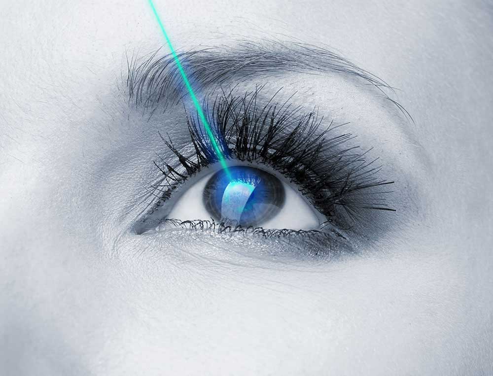 refractive surgery co-management
